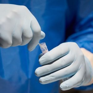 Apa Yang Harus Dilakukan Jika Anda Dites Positif di Austria